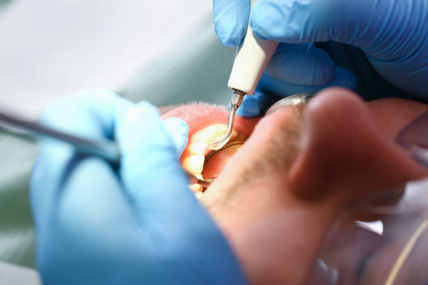 Best Broken or Cracked Tooth Emergency Dentist in State Center, IA