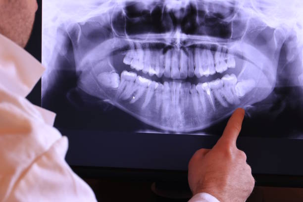 Best Orthodontic Emergency Dentist in State Center, IA